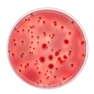 Bacteria Plate Count