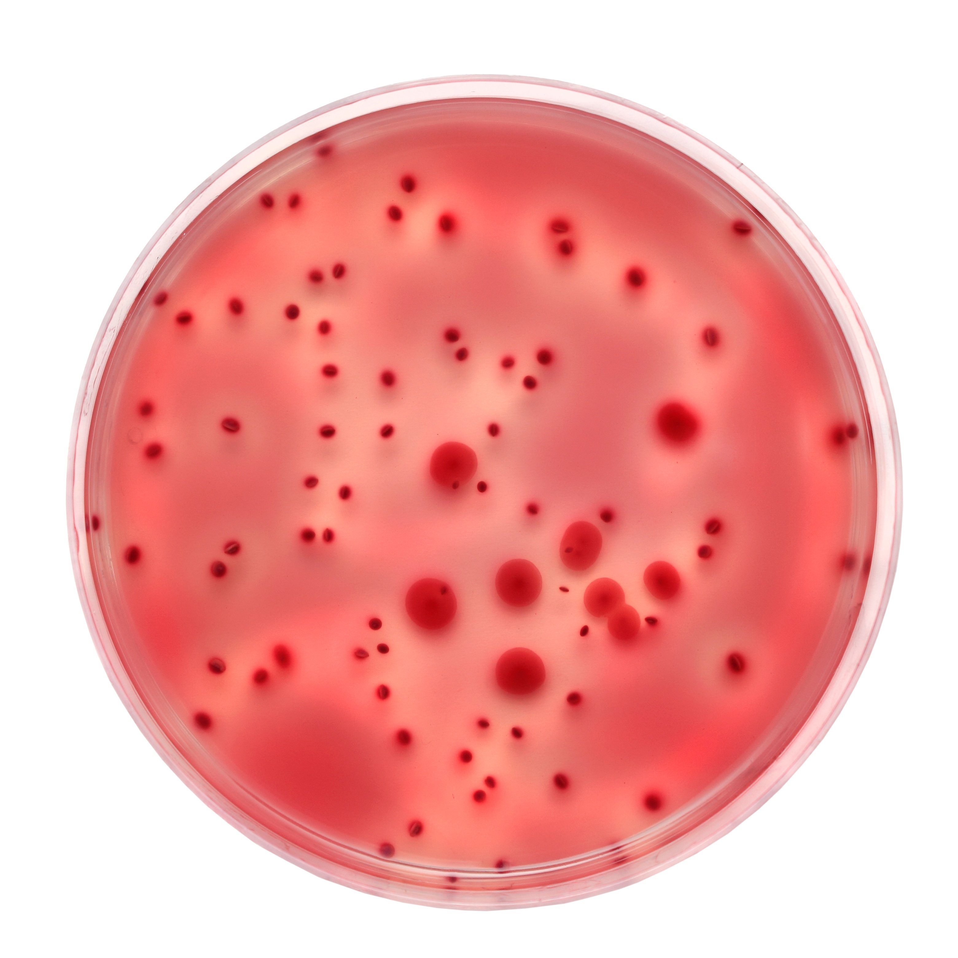 Bacteria Plate Count